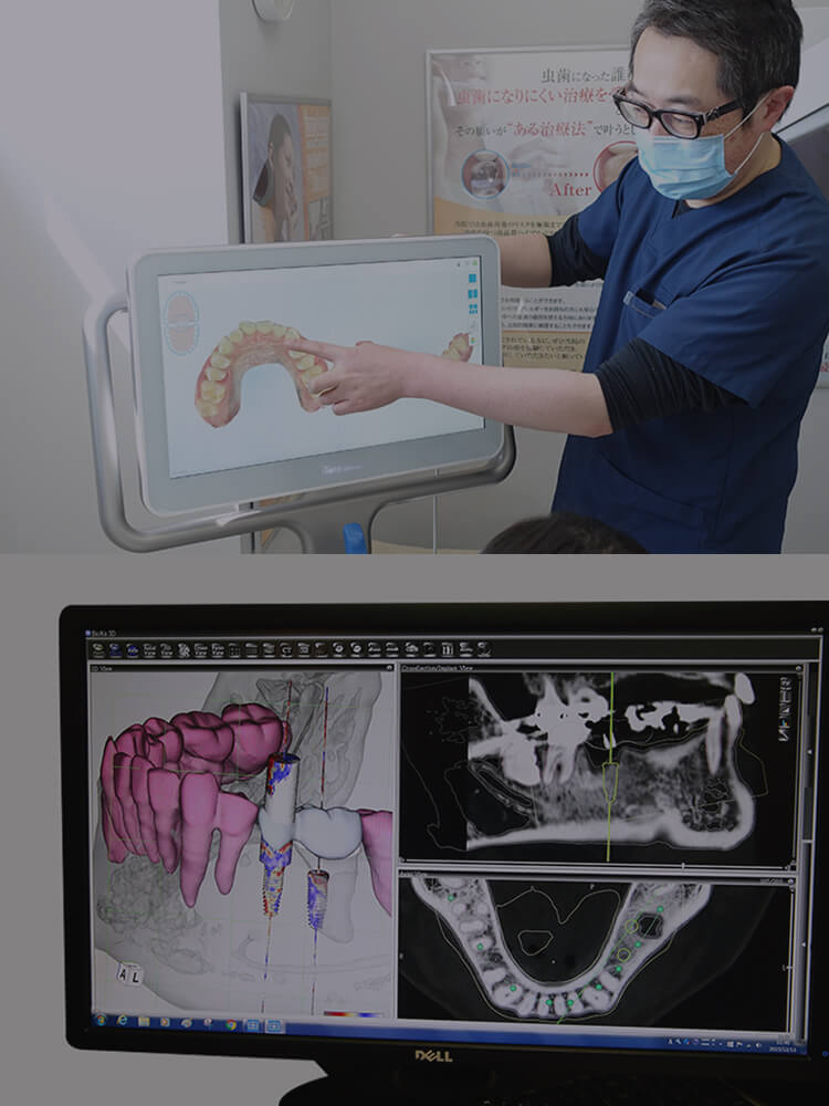 iTero、CT画像で説明する歯科医師